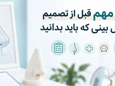 ۷ نکته مهم قبل از تصمیم برای عمل بینی که باید بدانید