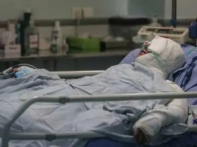 ۲ نفر در بناب دچار سوختگی شدید شدند