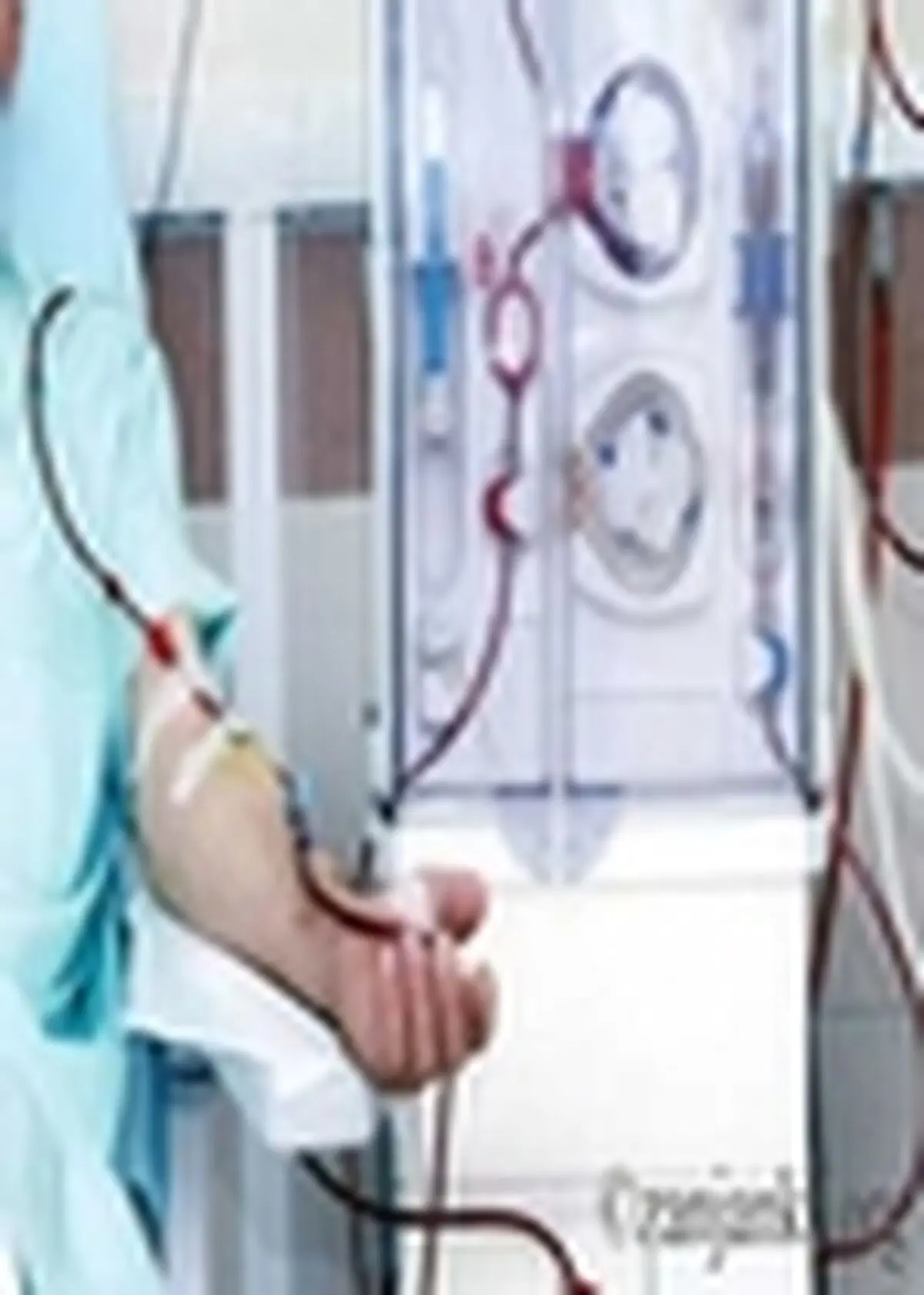 افزایش تعداد بیماران کلیوی زنجان، نگران کننده است