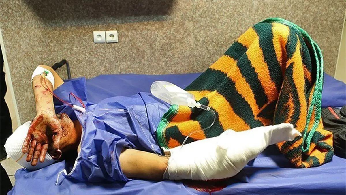 ۳۷۳ نفر مصدوم در حوادث مرتبط با چهارشنبه آخر سال در سراسر کشور 