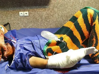 ۳۷۳ نفر مصدوم در حوادث مرتبط با چهارشنبه آخر سال در سراسر کشور 
