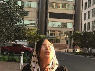 دوباره اسید را شکست دادم /ملاقات با رئیس‌جمهور  در نیویورک با چشمان بینا 