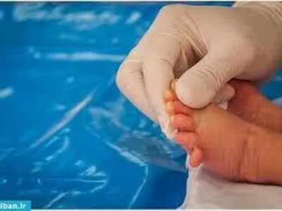 وایرال شدن کلیپ نوزاد ۶ انگشتی در فضای مجازی + فیلم