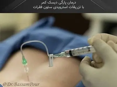 شایع ترین دلایل کمر درد و دلایل و روش های درمان آن