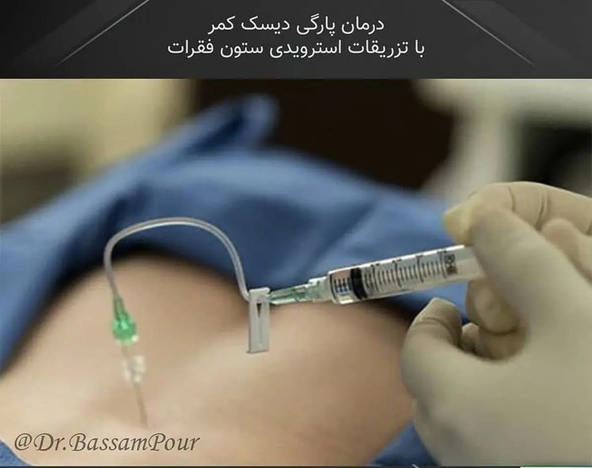 شایع ترین دلایل کمر درد و دلایل و روش های درمان آن
