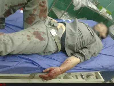 زخمی‌شدن ۲ محیط‌بان اصفهانی با گلوله متخلفان 