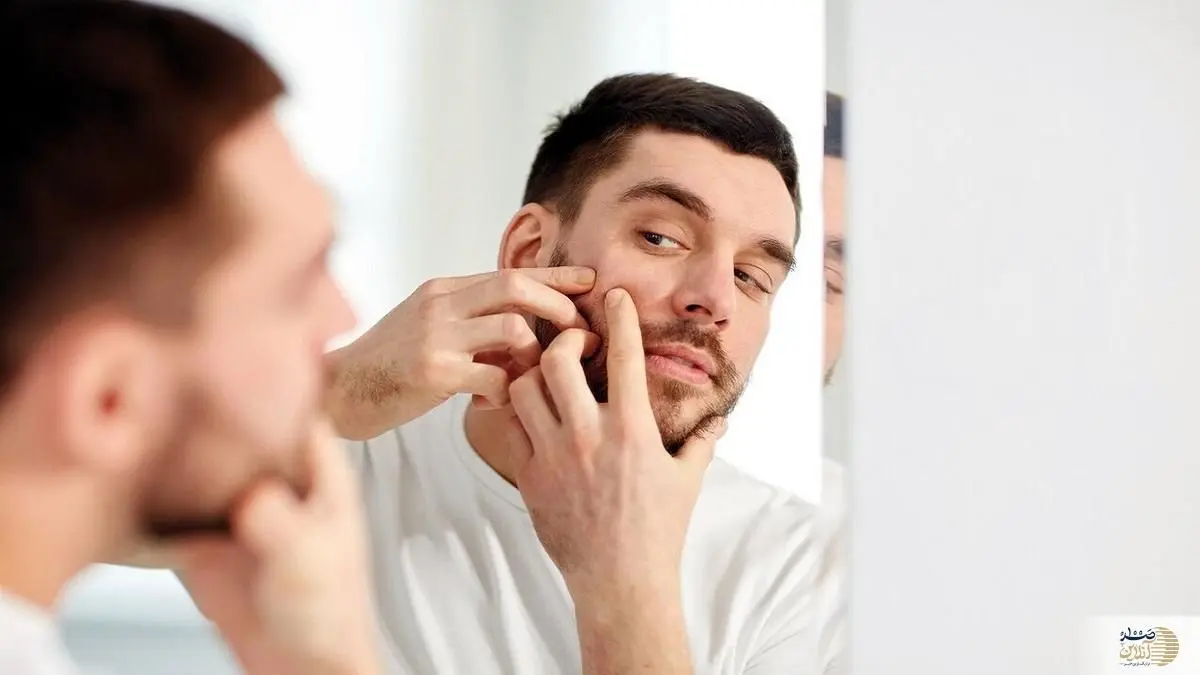 پنج ماده موثر برای پاکسازی پوست و نابودی آکنه 