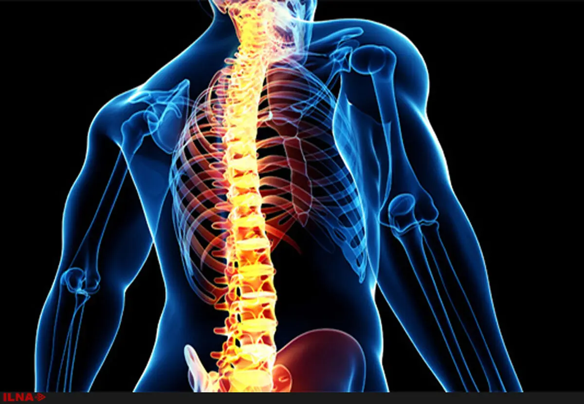 هشدار نسبت به عوارض ضایعات مادرزادی ستون فقرات/ ضرورت اطلاع رسانی به خانواده‌ها