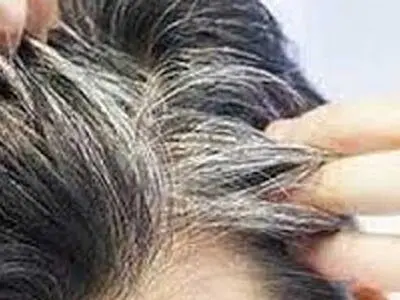 دلیل خشکی مو با وجود چربی کف سر چیست؟