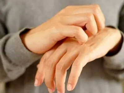 خطرات و عوارض جدی کندن زخم خشک شده
