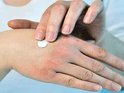 ۷ ماده غذایی برای مقابله با خشکی پوست 