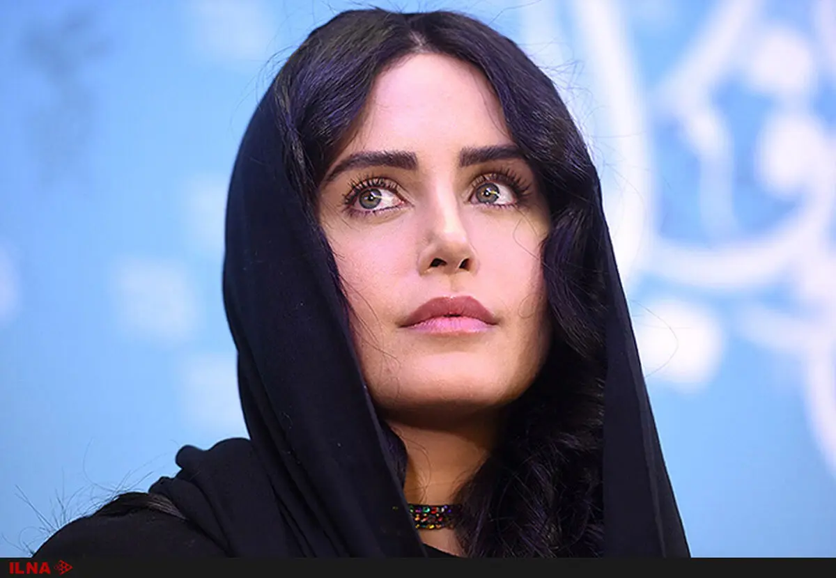 حادثه برای الناز شاکردوست سر صحنه فیلمبرداری/آسیب‌دیدگی جزئی از ناحیه کمر 