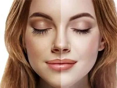 برنزه کردن پوست در تابستان با چند روش بدون ضرر