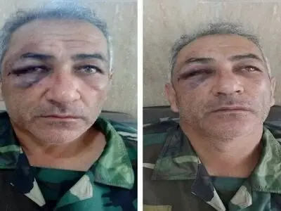 ضرب‌وشتم یک جنگلبان توسط قاچاقچیان چوب در آستارا