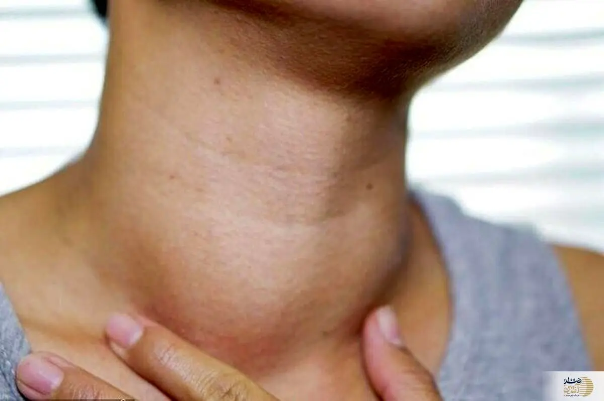 این علایم یعنی تیروئید شما کم کار است