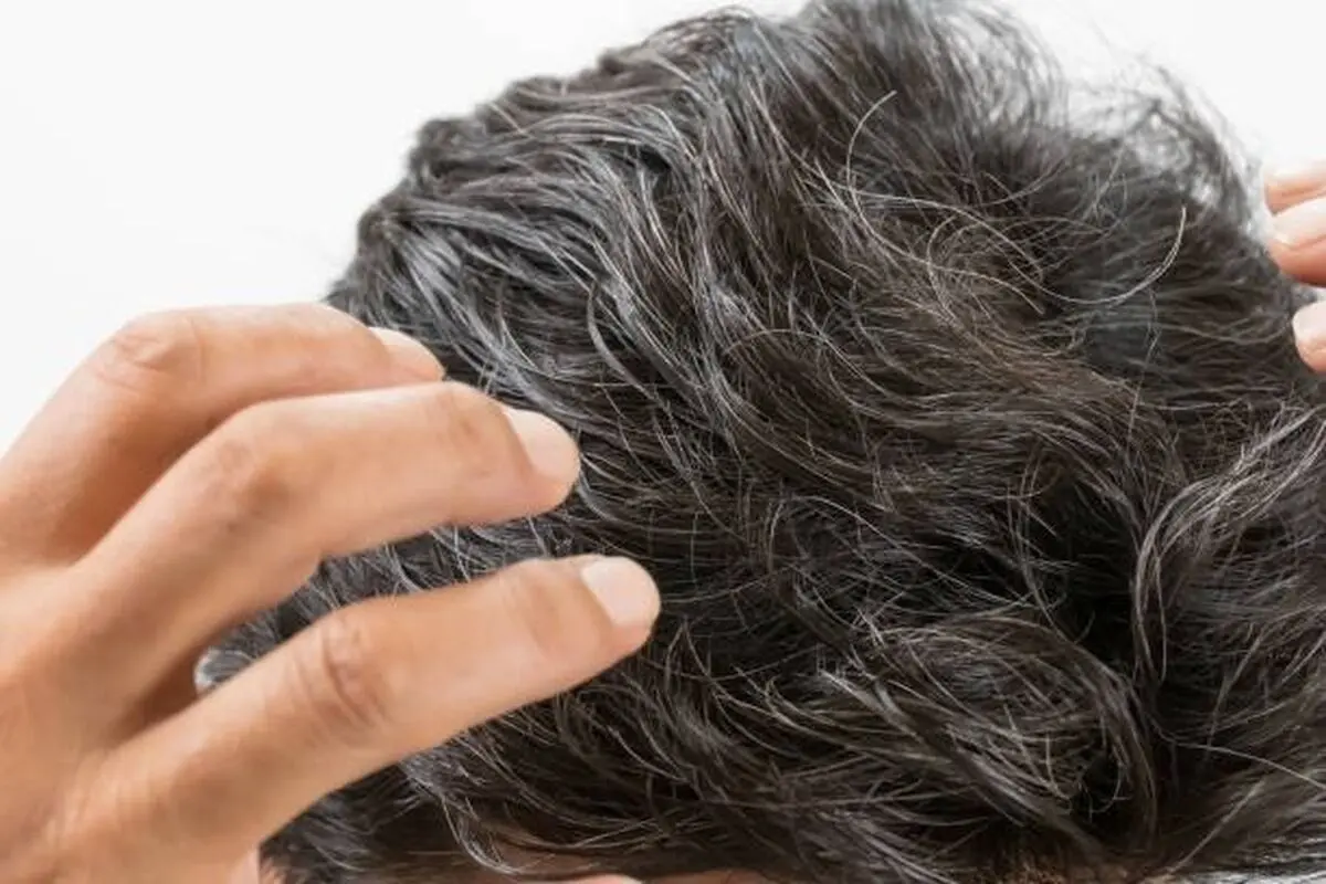 با این روش موهای سفید از بین می‌روند؟ 