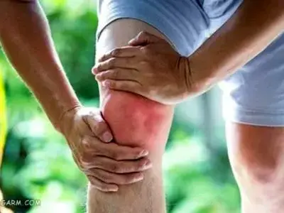 درمان خانگی آب آوردن زانو
