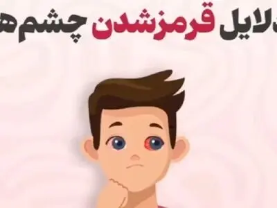 چه زمانی باید برای قرمز شدن چشم‌ها به پزشک مراجعه کرد؟ + فیلم