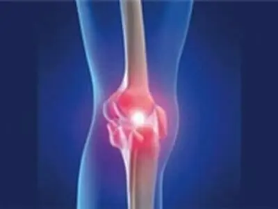 راهکار جدید تسکین درد آرتروز 