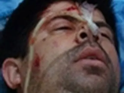 جراحت شدید دو محیط‌بان گلستانی با ضربات تبر / حال یکی از محیط بانان وخیم است