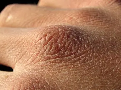 ۶ نکته برای رفع خشکی پوست در پاییز