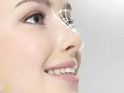 بهترین سن برای جراحی ترمیمی بینی 