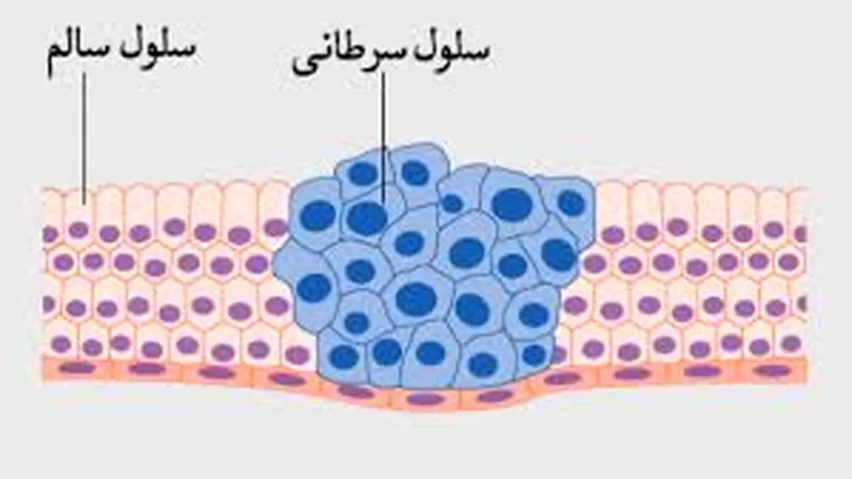 میوه ای شگفت آور جایگزین شیمی درمانی