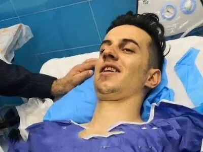 فک رضا حبیب‌زاده جراحی شد (عکس)