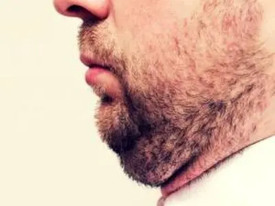 بررسی علل متفاوت ایجاد غبغب 