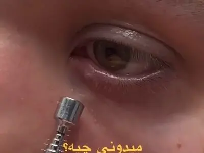 فقط یک لحظه غفلت / بینایی قابل جایگزین نیست ! + فیلم