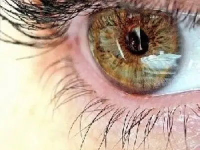 نزدیک بین بودن و دوربین بودن افراد هم ژنتیکی است؟