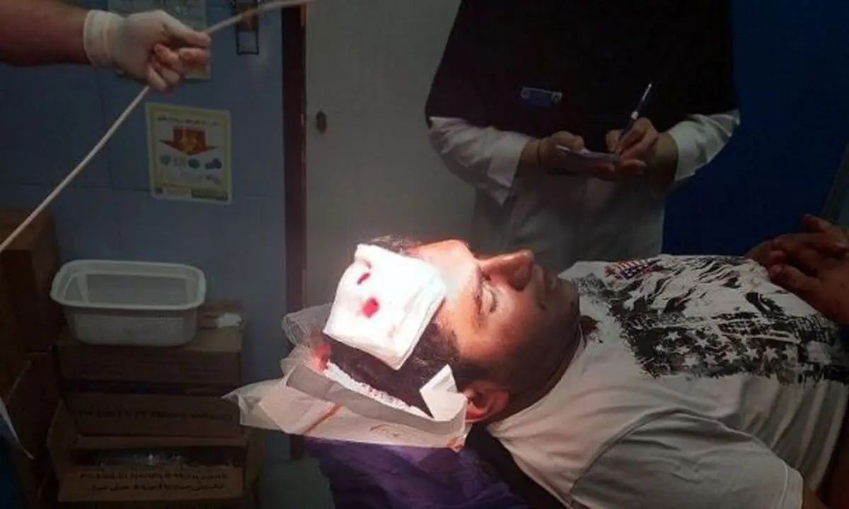 مجروح شدن ۲ مأمور منابع طبیعی در رضوانشهر