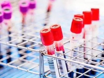 موفقیت دانشمندان در حذف ویروس HIV از سلول‌های آلوده 