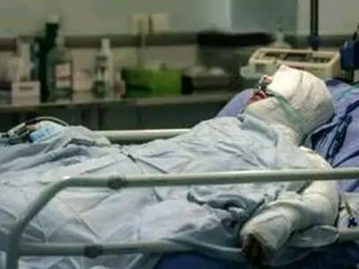 لباس‌‌های سوختگی هنوز بیمه نشده‌؛ هر دست لباس بین ۵ تا ۴۰ میلیون هزینه دارد