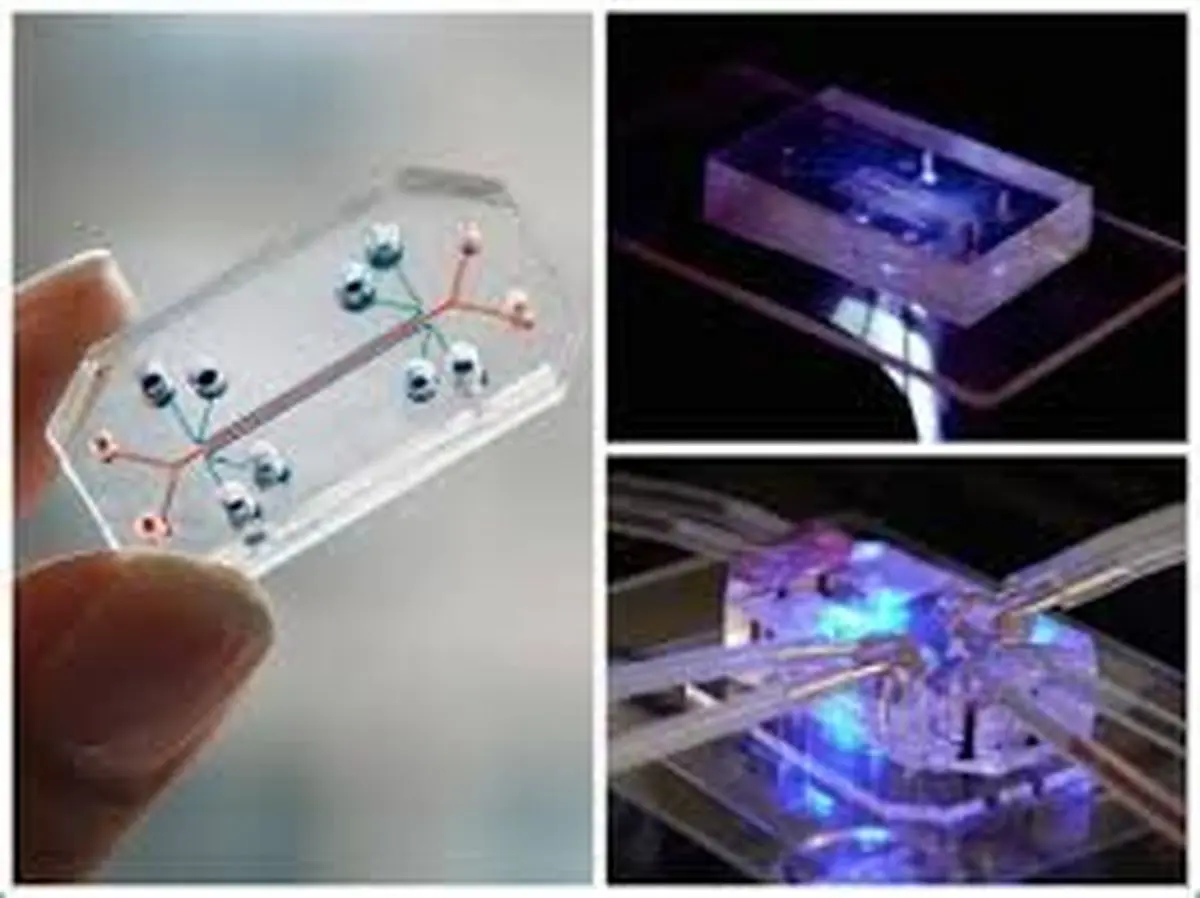 معجزه‌ای برای بیماران آلزایمر؛ خداحافظی با فراموشی