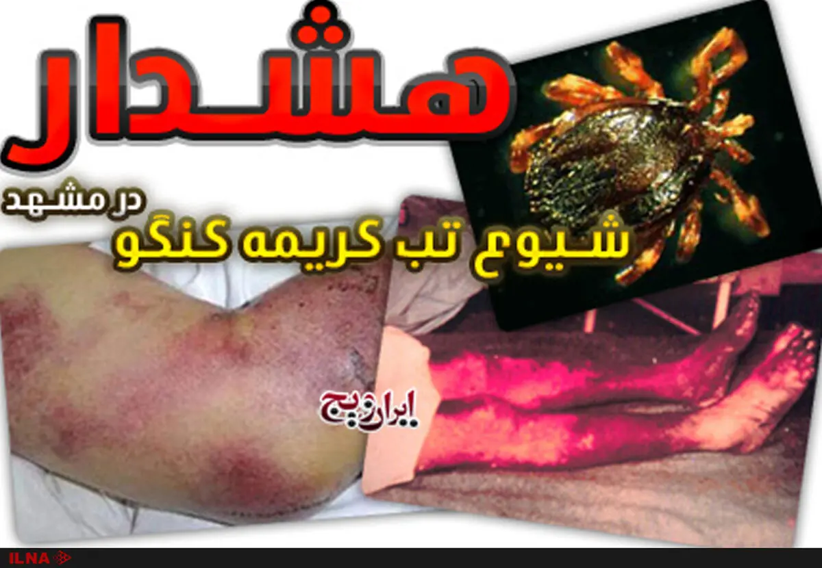 ابتلای ۳۳ نفر در کشور به تب کریمه کنگو/ مرگ 3 نفر و مبتلا شدن زن و شوهر کرمانشاهی