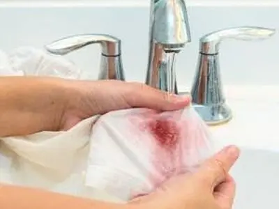شستشوی لکه خون خشک شده از سطوح مختلف
