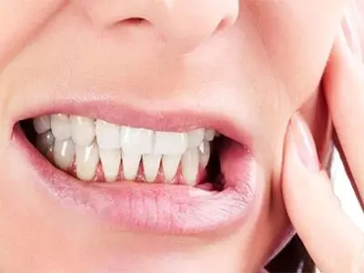 هشدار متخصص دندانپزشکی درباره عوارض جدی دندان‌قروچه 