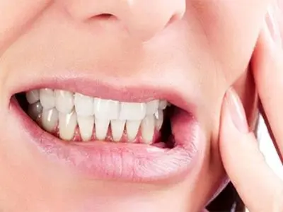 هشدار متخصص دندانپزشکی درباره عوارض جدی دندان‌قروچه 