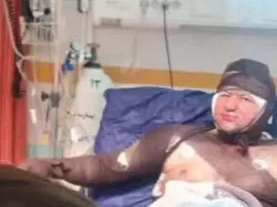 فرد مصدوم دچار حریق شده در مجموعه بام خرم آباد فوت کرد