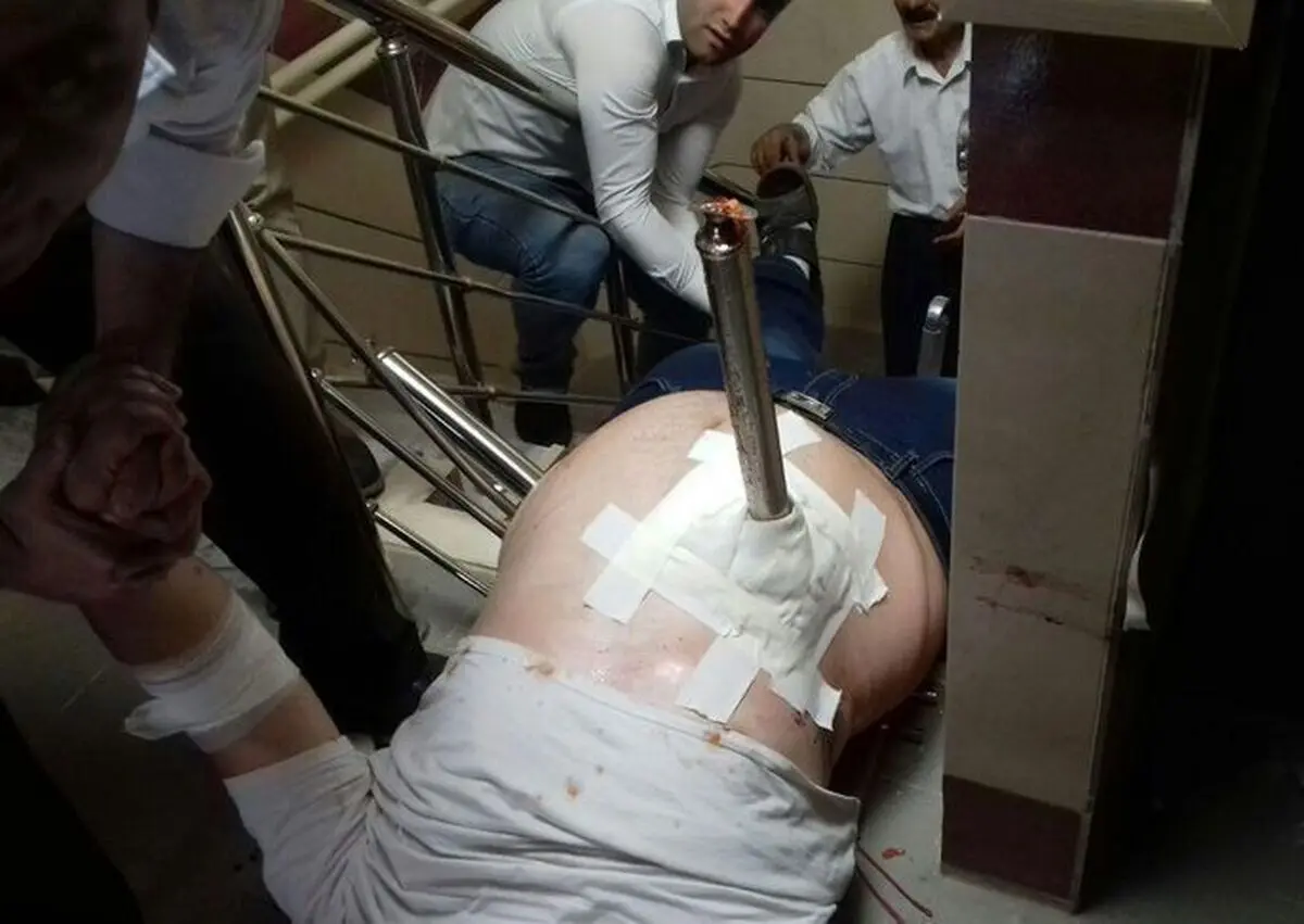 فرورفتن میله نرده به داخل شکم پسر 23 ساله در بوکان + تصاویر (14+)