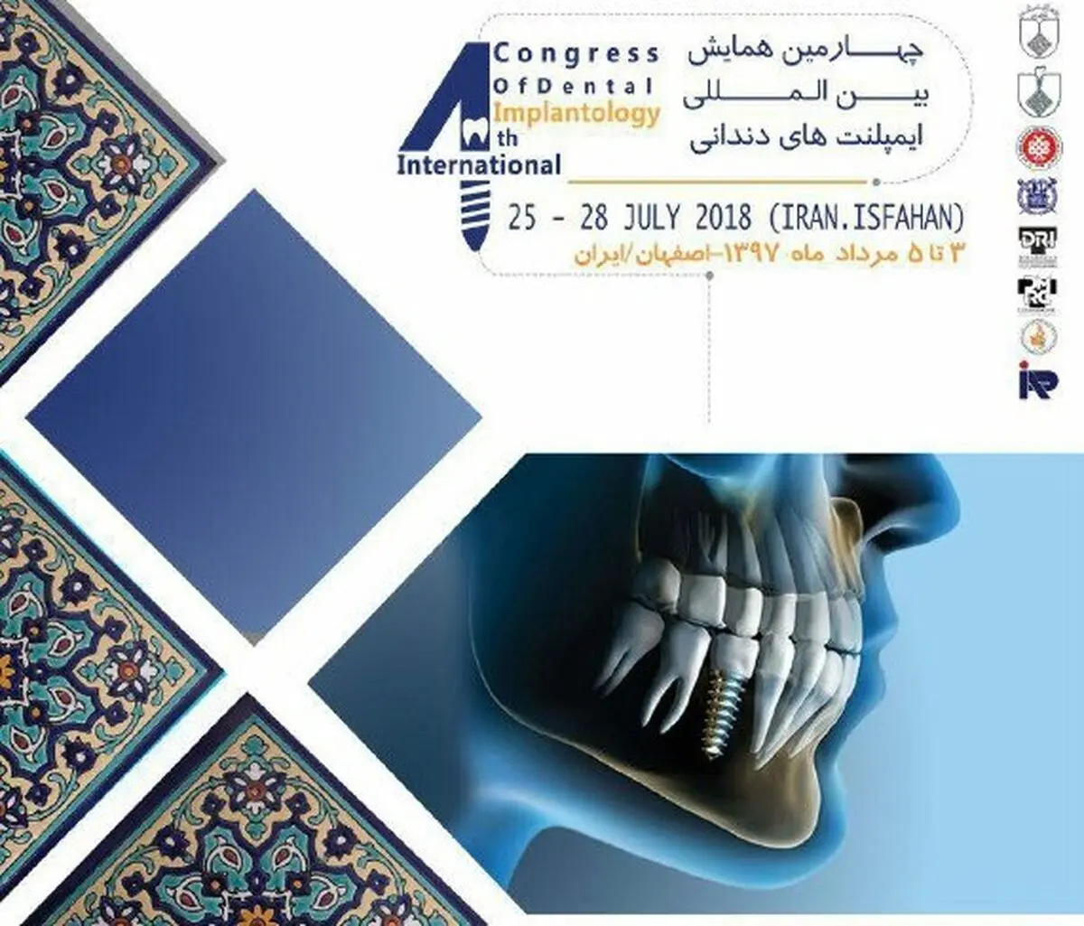 ارائه جدیدترین دستاوردهای علمی در حوزه کاشت ایمپلنت دندانی/ چه افرادی برای انجام ایمپلنت مناسب نیستند