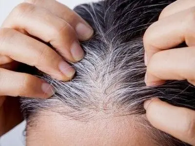 دلیل سفید شدن موها ، چرا مو سفید می شود.
