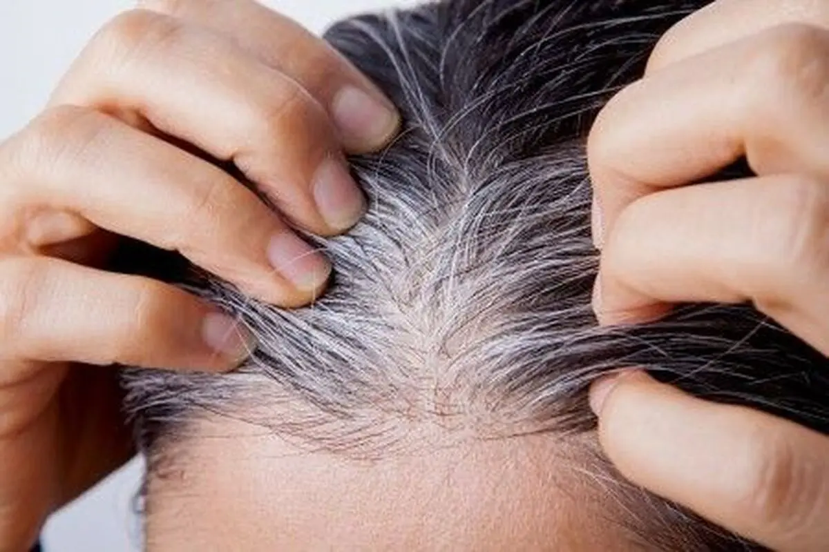 دلیل سفید شدن موها ، چرا مو سفید می شود.