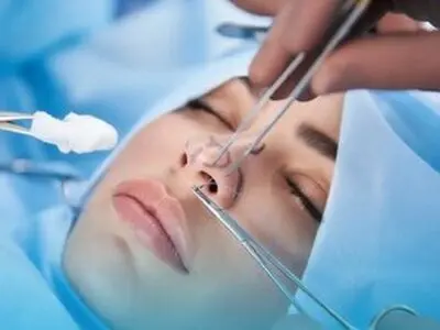جراحی بینی بدون بیهوشی توسط دستیار دیپلمه پزشک