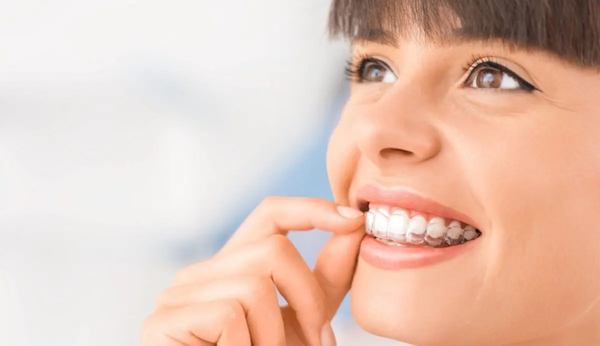 ارتودنسی نامرئی راهی جدید به سوی لبخندی خاص