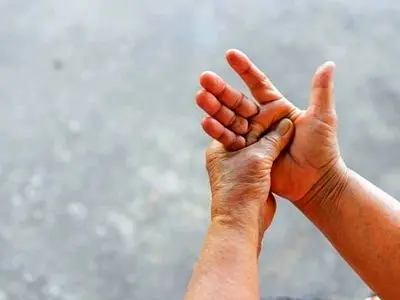 ورم دست و پا در روزهای گرم طبیعی است یا نشانه بیماری؟ 