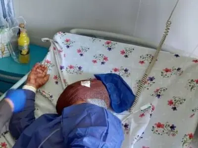 حمله موتورسوار ناشناس به مأمور بوستان بهار مشهد/  شناسایی ضارب فراری به طور تصادفی در بیمارستان