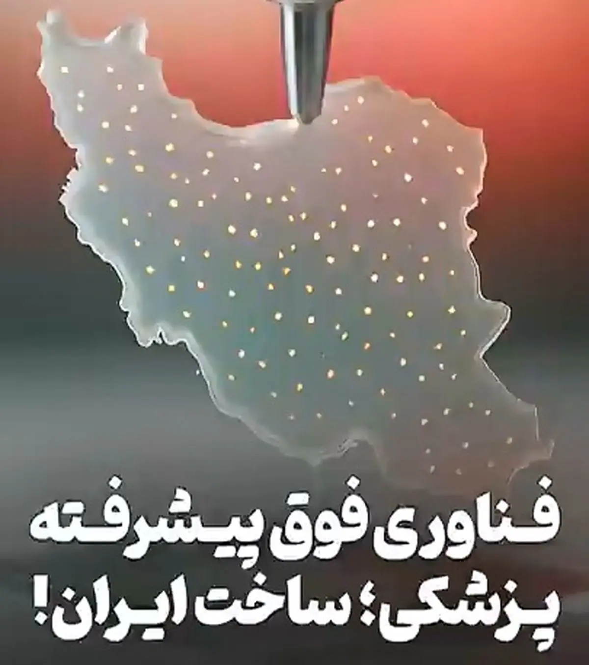 ورود ایران به باشگاه فناوری‌های فوق ‌پیشرفتۀ پزشکی در دنیا، این هم مدرکش! + فیلم