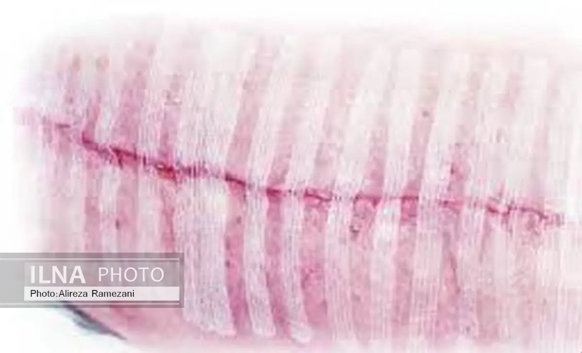 چسبی که جایگزین بخیه می شود+عکس 